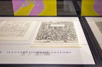 A display case containing two prints illustrating medical examinations in the 16th century